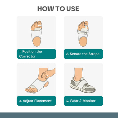 Premium Bunion Corrector: 1 Pair (2 Correctors)